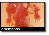 Foto de um aborto - 7 semanas