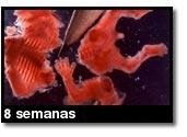 Foto de um aborto - 8 semanas