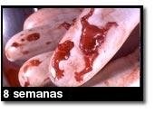 Foto de um aborto - 8 semanas