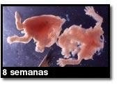 Fotografía de aborto - 8 semanas