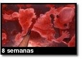 Fotografía de aborto - 8 semanas